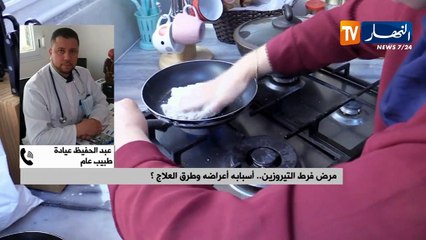 طبيب عام  مرض فرط التيروزين نادر جدا ويمكن إكتشافه مبكرا