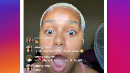 Un’influencer perde i capelli durante una diretta Instagram