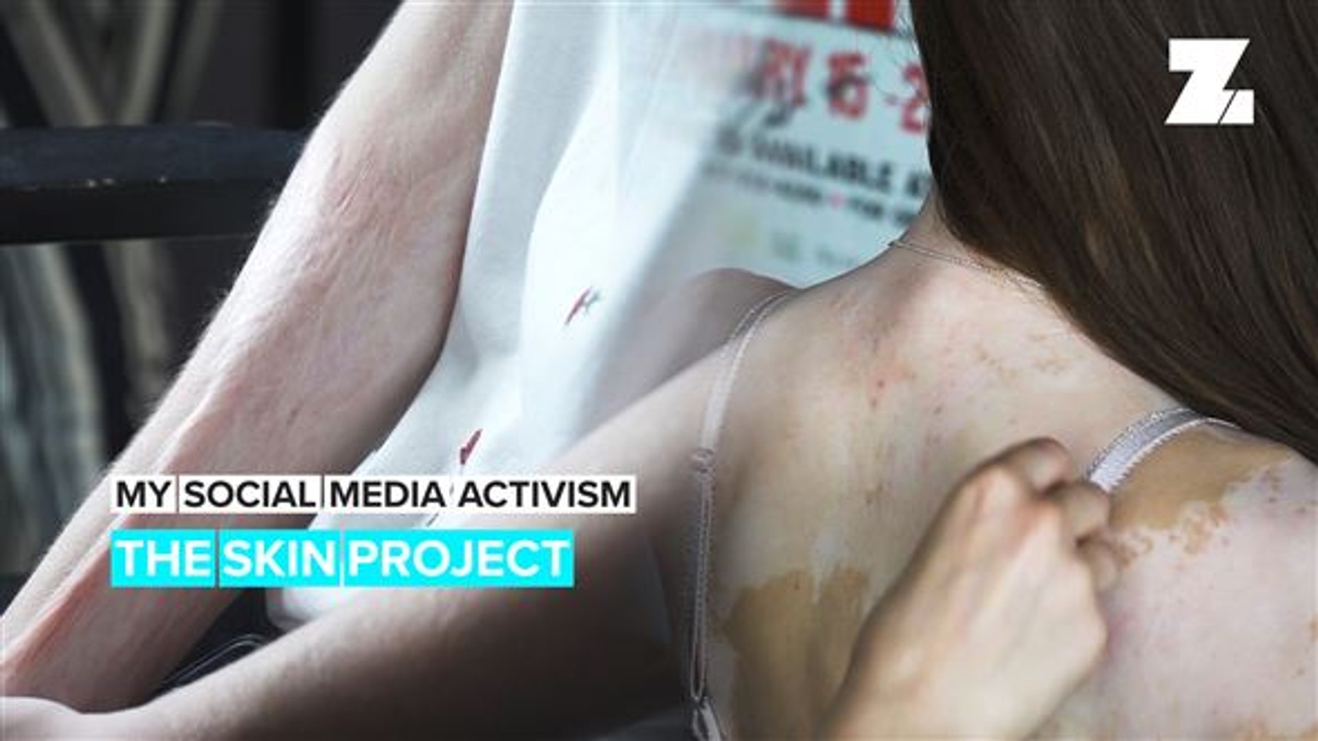 ⁣My Social Media Activism: Behind #ProjectTheSkin