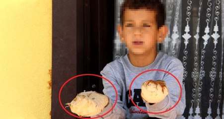 14 yaşındaki çocuk, oyun arkadaşının ellerini kolonya döküp çakmakla yaktı