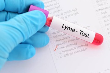 Les cas de maladie de Lyme en hausse en 2018