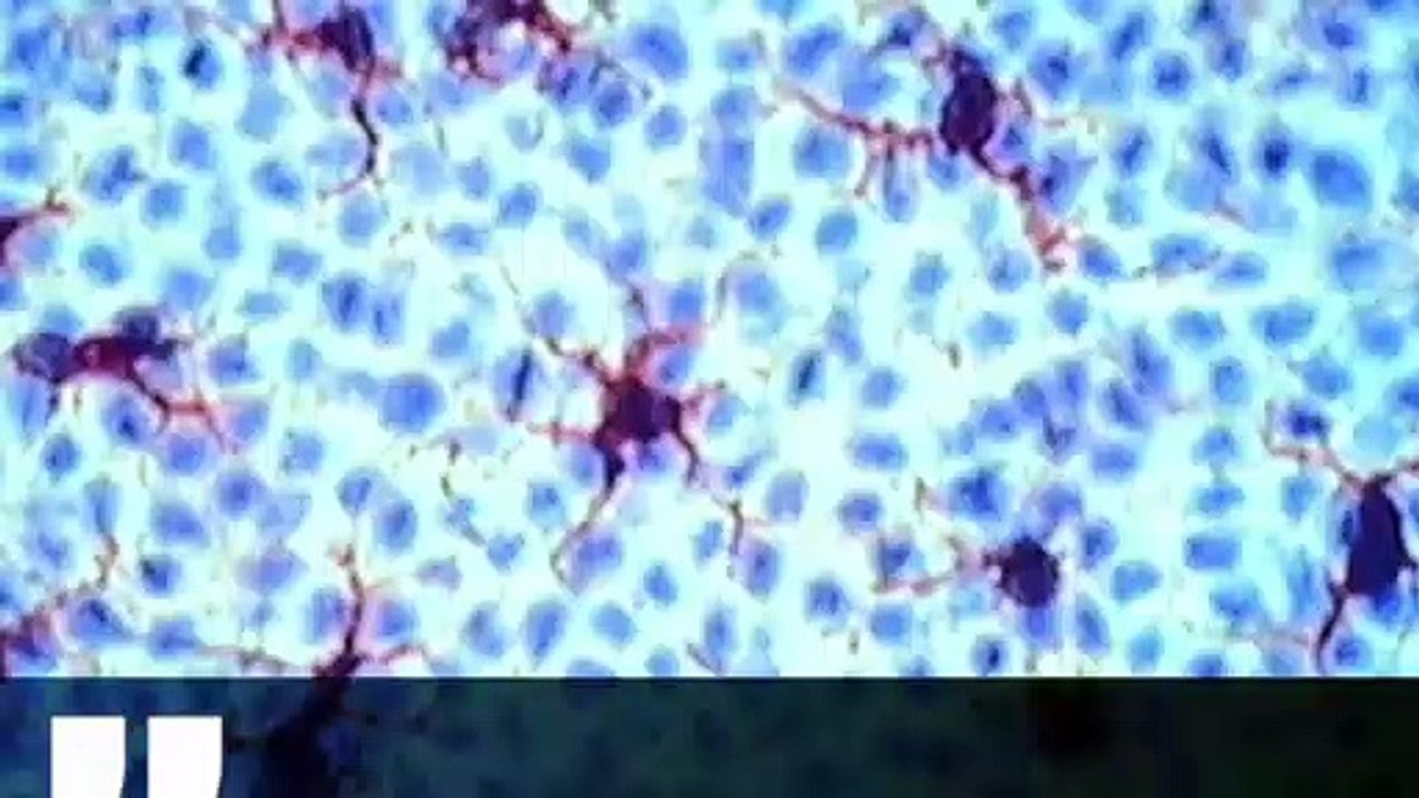 “Un vaccino universale” contro il cancro 3696