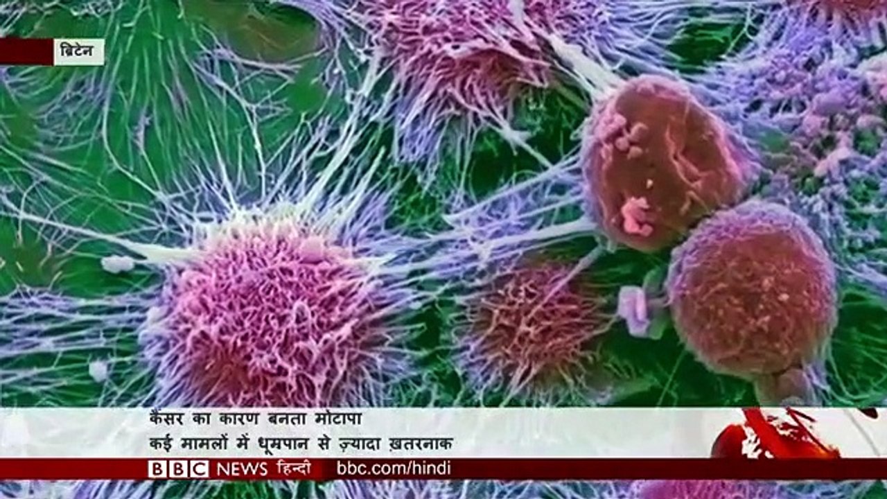 Smoking से ज़्यादा क्या Obesity से हो सकता है Cancer का ख़तरा? (BBC Hindi)