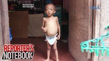 Reporter's Notebook: Batang may Primary Slerosing Cholengitis, nangangailangan ng liver transplant