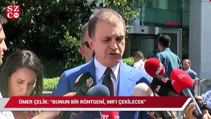 Ömer Çelik: Bunun bir röntgeni, MR’ı çekilecek