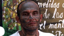 Borrarse los tatuajes, una aspiración de expandilleros en El Salvador