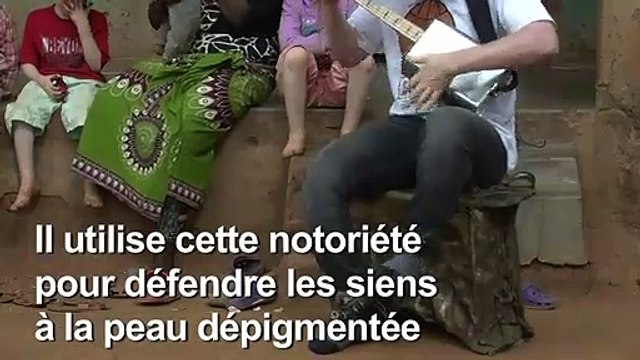 Malawi: portrait d'un musicien albinos à la renommée mondiale