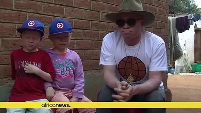 Malawi : un fils de Salif Keita au service de la cause albinos