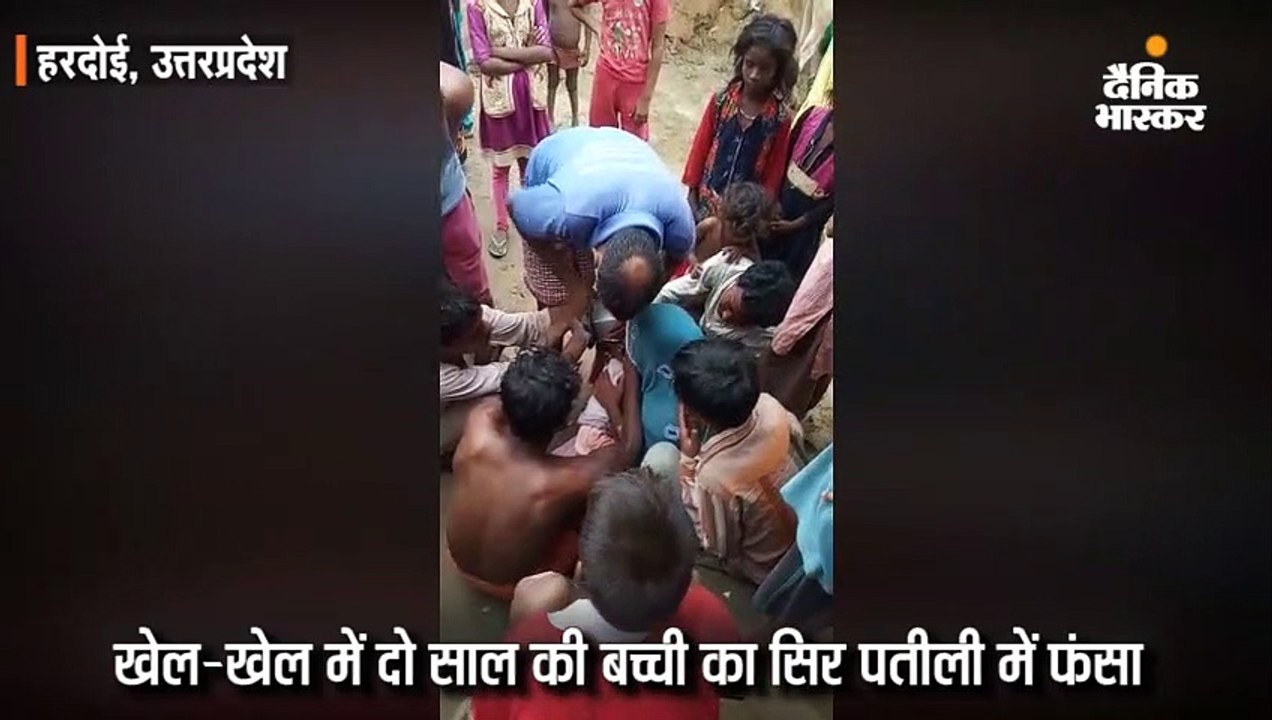 खेल-खेल में दो साल की बच्ची का सिर पतीली में फंसा