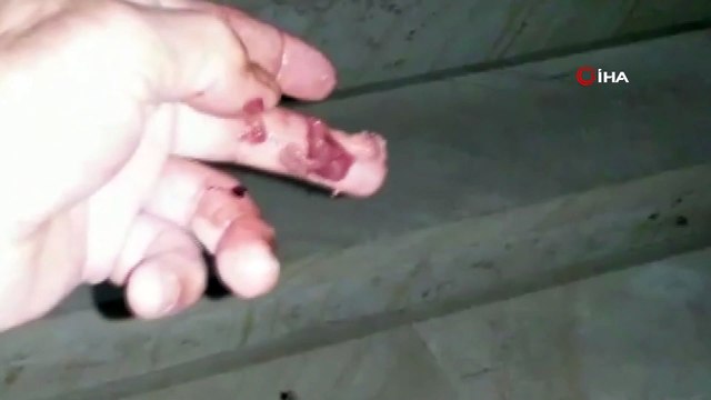 - Bahçesine gelen tilkiyi eliyle besledi