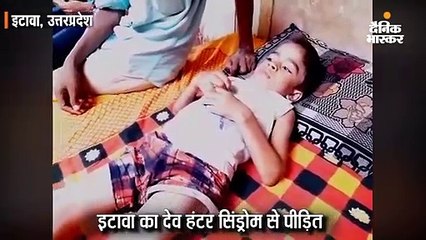 इटावा का देव हंटर सिंड्रोम से पीड़ित; इसके इलाज का खर्च 1.92 करोड़, सिर्फ 5 लाख की मदद मिली