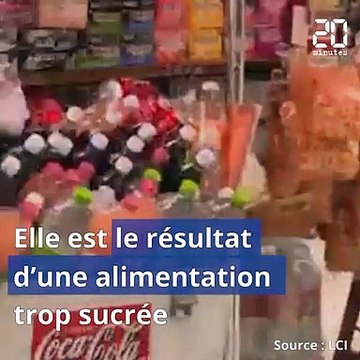 Boire une seule canette de soda par jour, c'est déjà nocif pour le foie