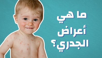 ما هي أعراض الجدري؟
