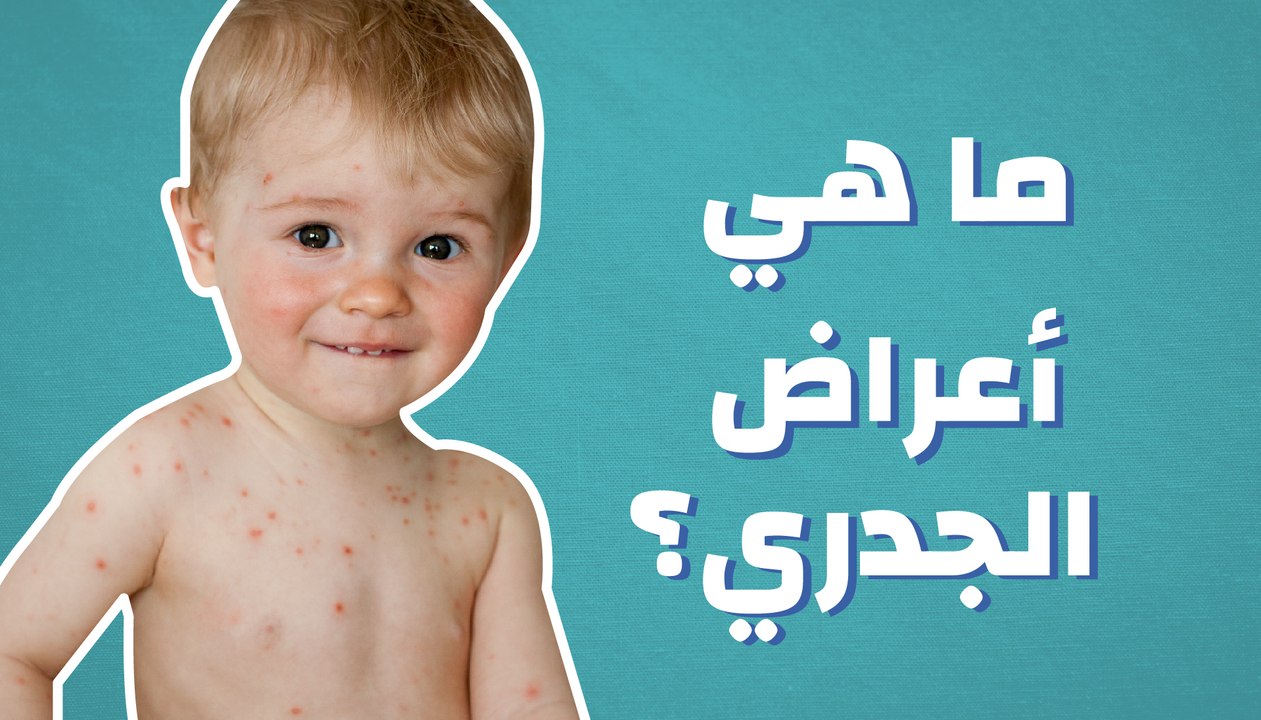 ما هي أعراض الجدري؟
