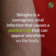 Shingles Vaccine Has Been Reported to Cause Shingles Virus