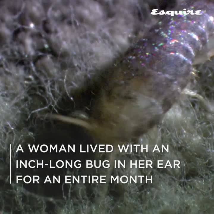 A Woman Lived With An Inch-Long Bug In Her Ear For An Entire Month