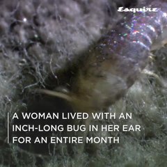 A Woman Lived With An Inch-Long Bug In Her Ear For An Entire Month
