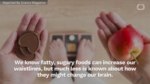 Fatty Foods May Change Our Brain And Cause Us To Overeat