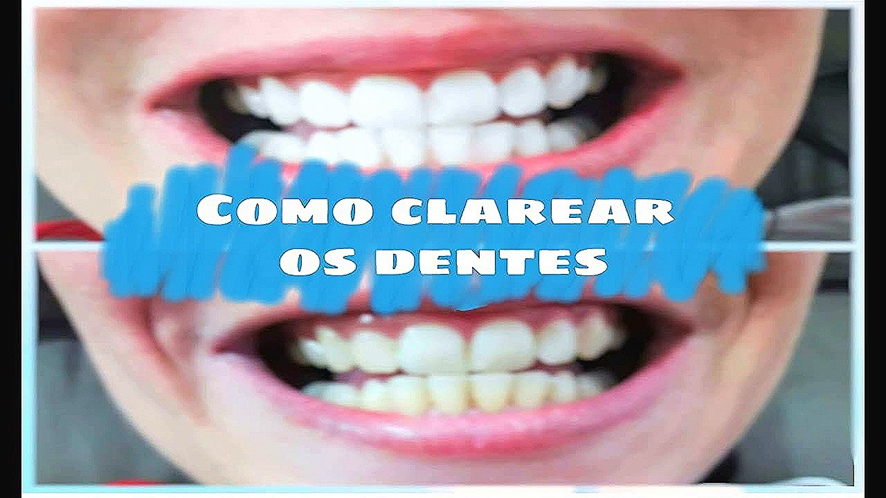 Como clarear os dentes em casa - EM MINUTOS!
