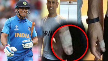 World Cup 2019: MS Dhoni played with a broken thumb in Semis against Kiwis | वनइंडिया हिंदी