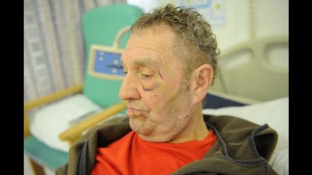 Pensioner relives horrific attack