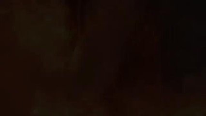 Scarred for Life Bonfire Night safety campaign