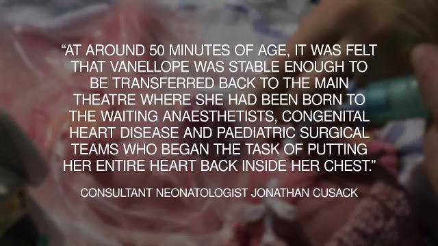 Baby survives being born with her heart outside her body