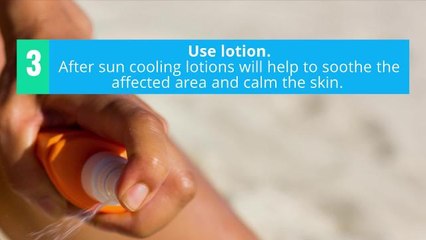 How to Get Rid of Sunburn