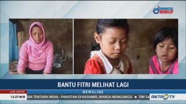 Derita Sindrom Steven Johnson, Fitri Terpaksa Putus Sekolah