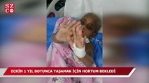 3 yaşındaki Ecrin 1 yıl boyunca yaşamak için hortum bekledi!