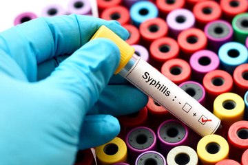 Syphilis : hausse spectaculaire du nombre d’infections en Europe