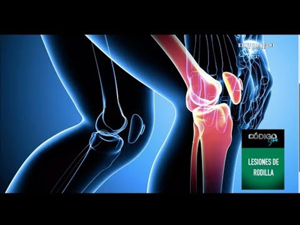 ¿Cuales son los padecimientos de rodilla más comunes?