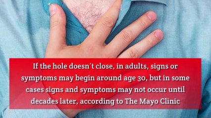 What is Atrial Septal Defect