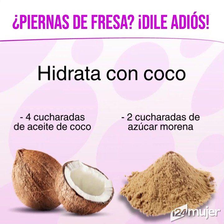 ¿Tienes piernas de fresa? Estos tratamientos naturales te pueden ayudar
