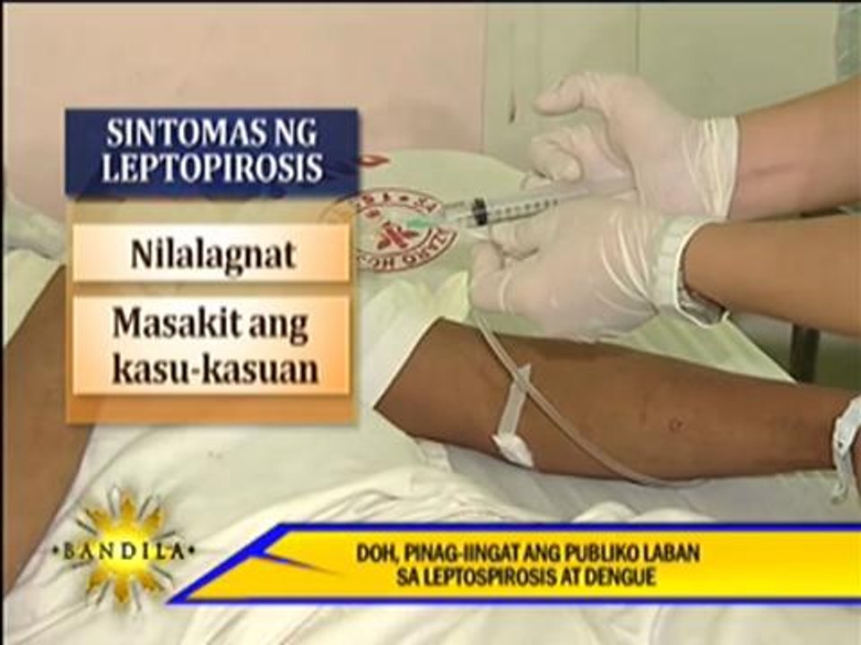 DOH warns public over rainy season diseases
