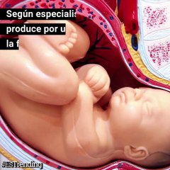 El extraño caso de Itzamara, la bebé que ‘nació embarazada’ de su hermano gemelo...