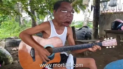 Gizemli Hastalık Yüzünden Kafası 3 Kat Büyüdü