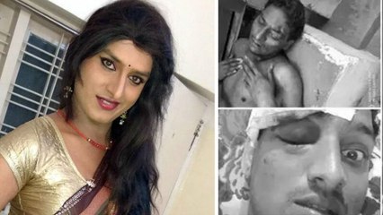 Comedian Vinod Injured Severely In Hyderabad || Filmibeat Telugu