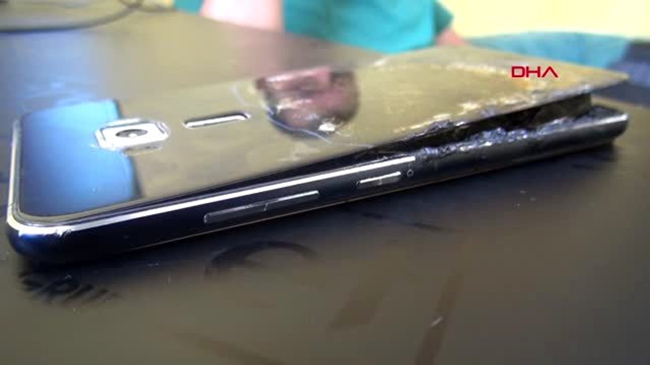 KARAMAN CEBİNDEKİ TELEFONUN BATARYASI PATLAYAN SÜRÜCÜ YARALANDI