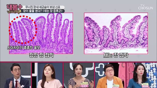 무너져버린 장내 세균 숲이 내 몸을 살찌운다?!