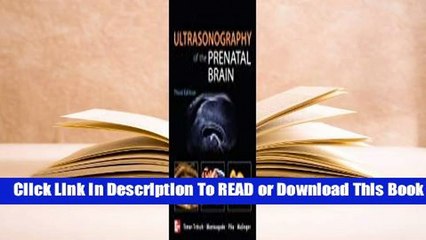 Online Ultrasonography of the Prenatal Brain  For Kindle