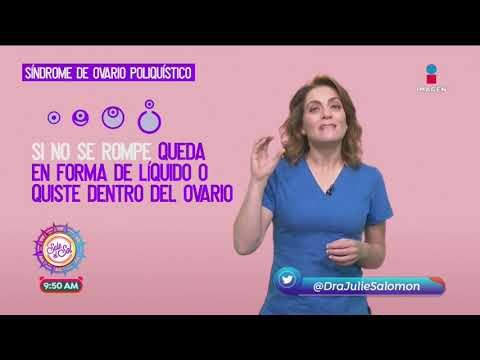 ¿Qué es el síndrome de ovario poliquístico? | Sale el Sol