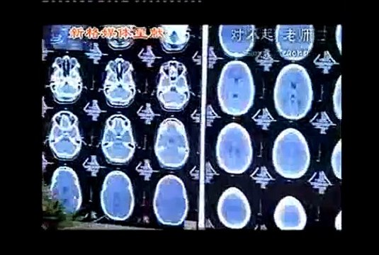 Извините, Учитель ролик от субтитры от супомена