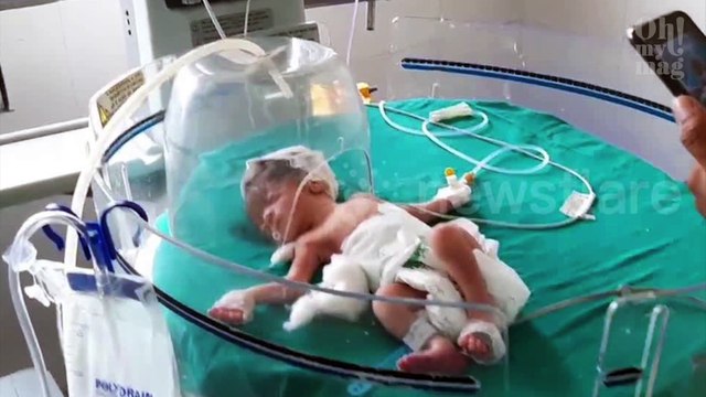 Momento drástico en que unos perritos callejeros salvan la vida de un bebé hallado en una alcantarrilla 15070