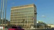 Brain Differences Found In US Diplomats After Mysterious 'Sonic Attacks' In Cuba