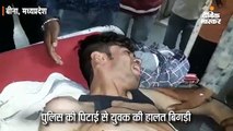 पुलिस की पिटाई से युवक की हालत बिगड़ी