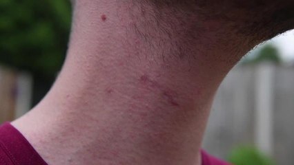 Will Fraser-Gray says thank you for support after US horror crash recovery