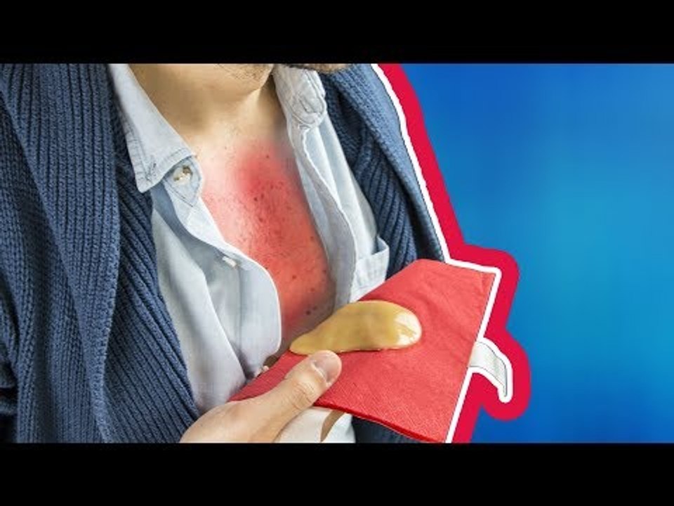 Bist du erkältet? Hast du Husten? Dann probier mal dieses 3-Zutaten-Hausmittel aus!