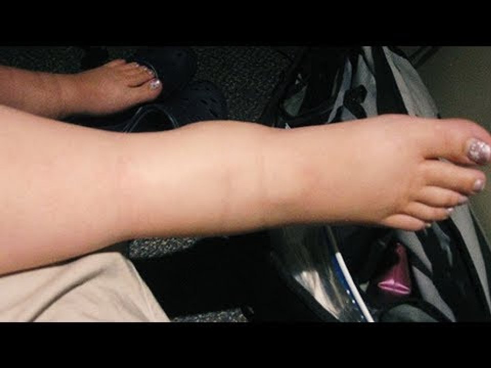 Wenn du wegen der Hitze geschwollene Füße hast, wird das hier dein Leben verändern!