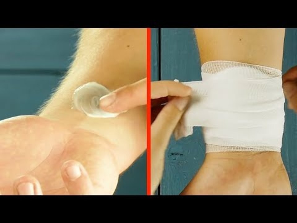 Schmiere Zahnpasta auf den Arm. Am nächsten Tag bist du sprachlos!